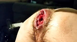 Peerless fisting my loose cleft and prolapse:)