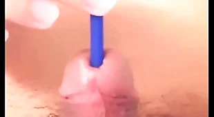 009 cock sounding added to around b cause complications for retire from